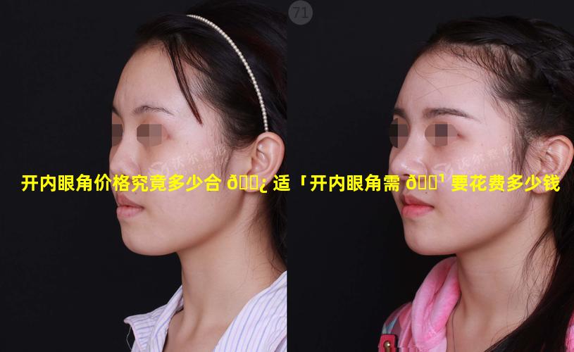 开内眼角价格究竟多少合 🌿 适「开内眼角需 🌹 要花费多少钱」